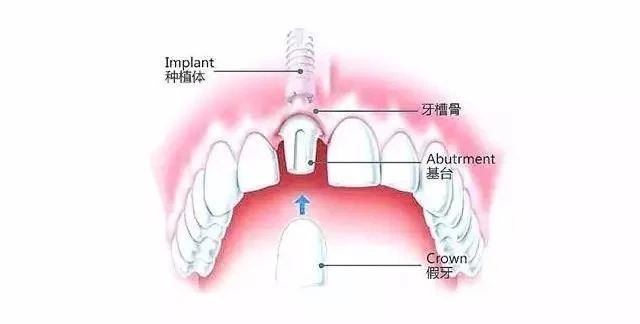 微信图片_20200905110622 微信图片_20200905110622.jpg